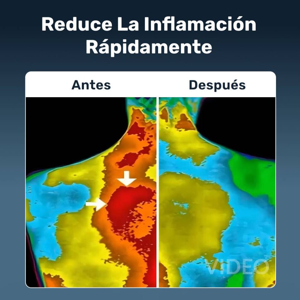 Bareflow image